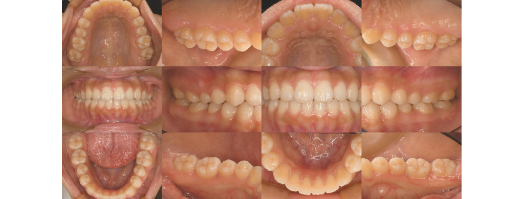 東住吉区南田辺・医療法人弘歯会 大森歯科・矯正歯科 Maintenance Clinic・口腔内規格写真(12枚法)