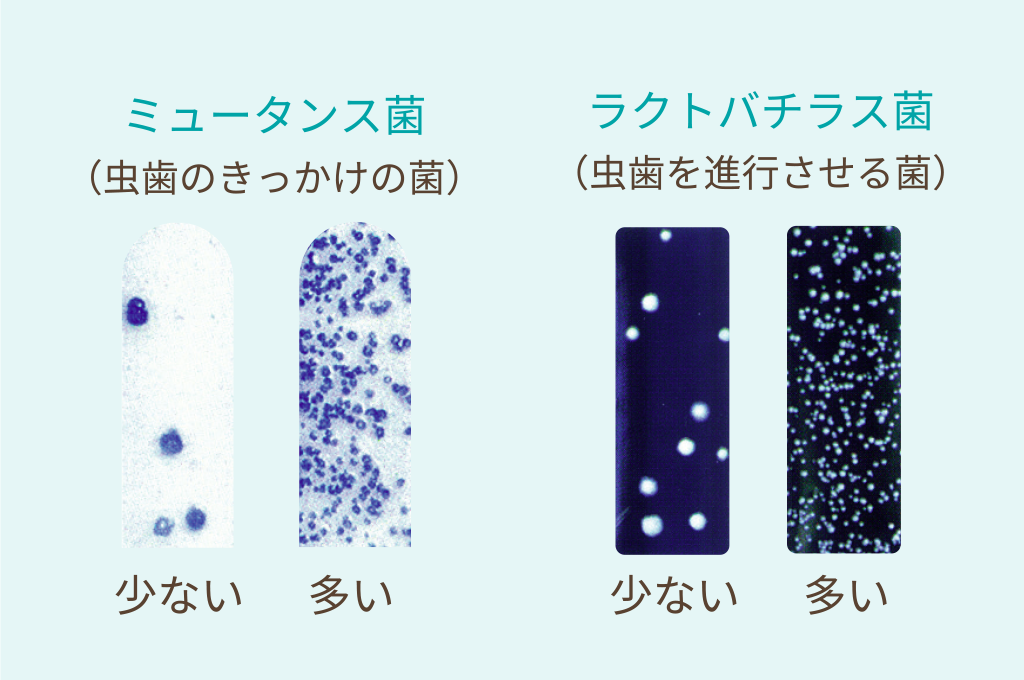 東住吉区南田辺・医療法人弘歯会 大森歯科・矯正歯科 Maintenance Clinic・ミュータンス菌、ラクトバチラス菌