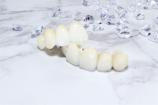 東住吉区南田辺・医療法人弘歯会 大森歯科・矯正歯科 Maintenance Clinic・審美治療